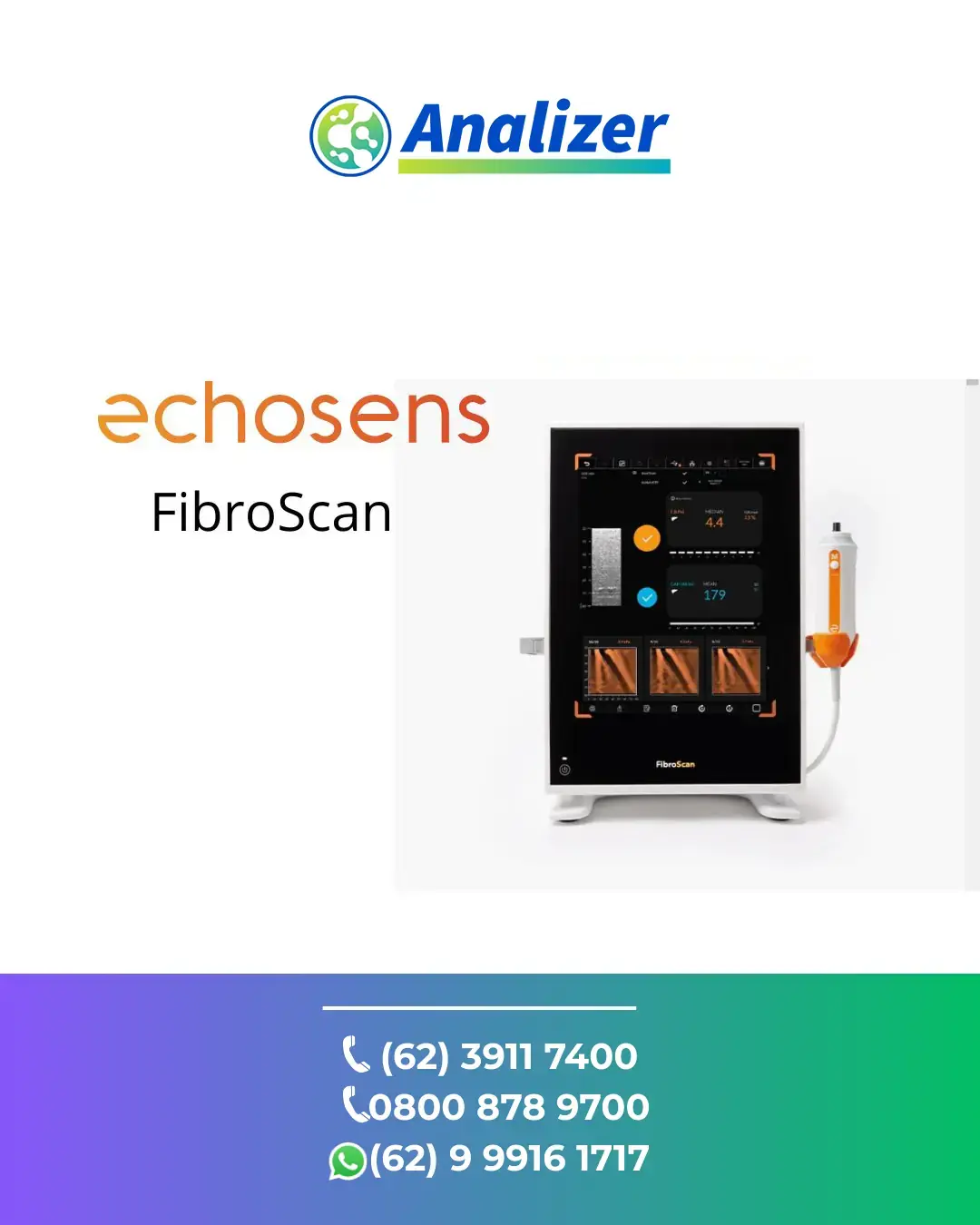 REPARO FIBROSCAN DA ECHOSENS TERESINA